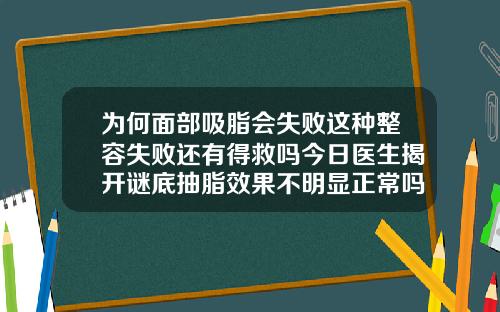 为何面部吸脂会失败这种整容失败还有得救吗今日医生揭开谜底抽脂效果不明显正常吗